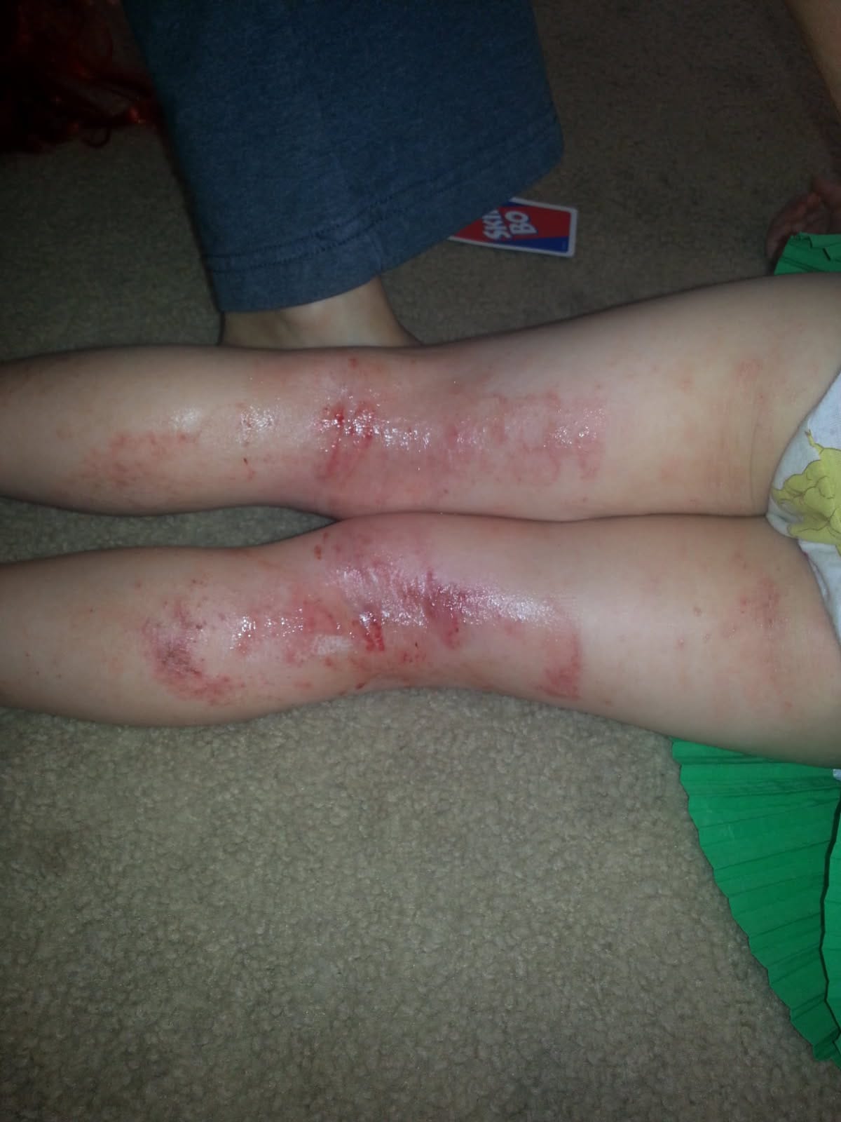 Condition Before Treatment